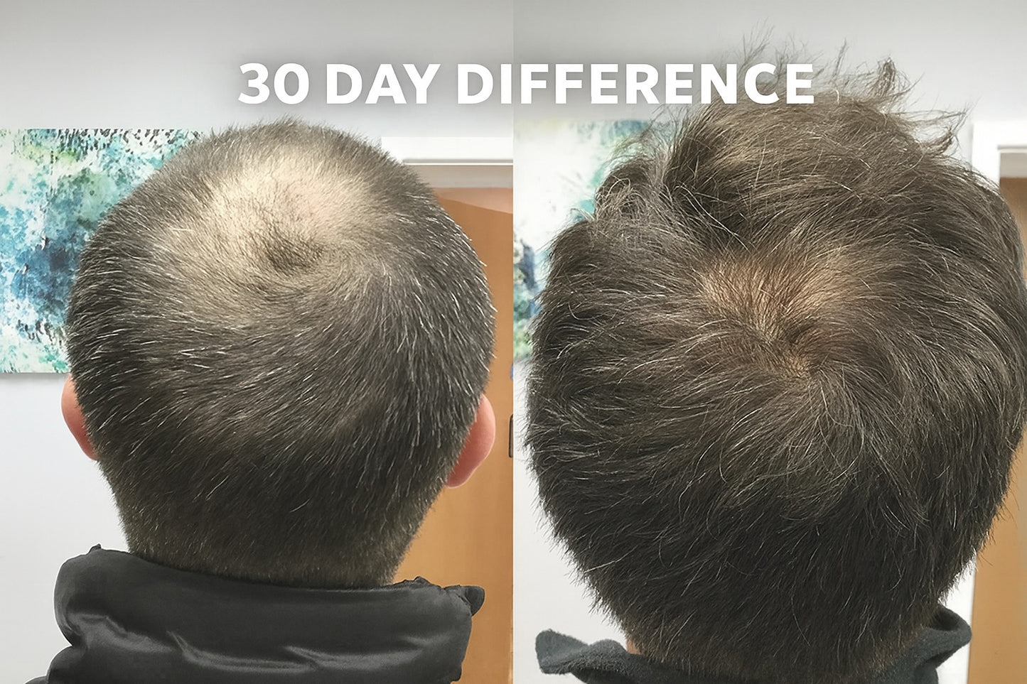 Hair Growth Roll-On Serum