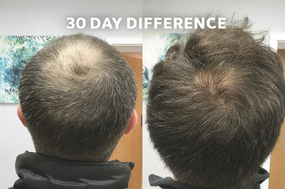 Hair Growth Roll-On Serum