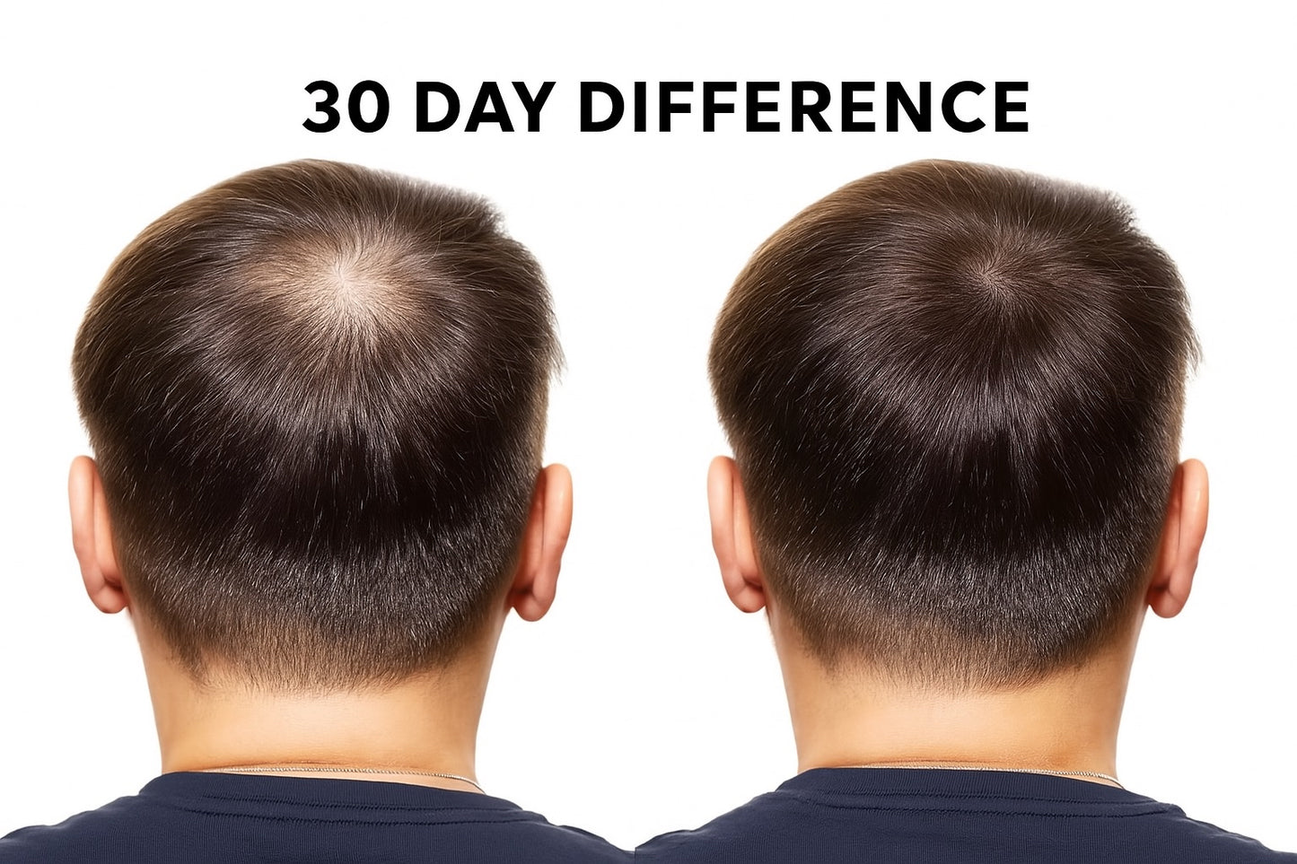 Hair Growth Roll-On Serum