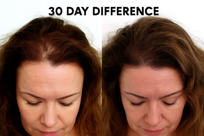 Hair Growth Roll-On Serum